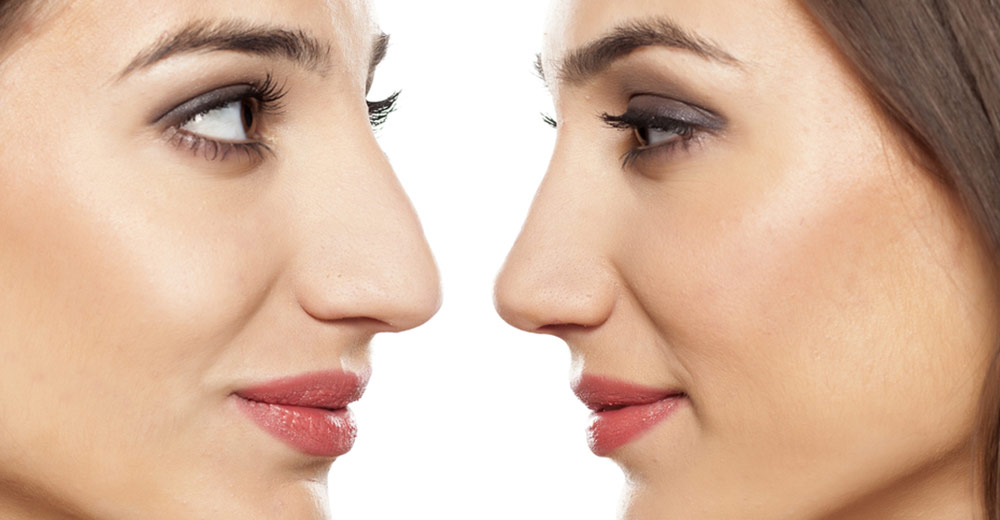Choosing the right nose for your face!